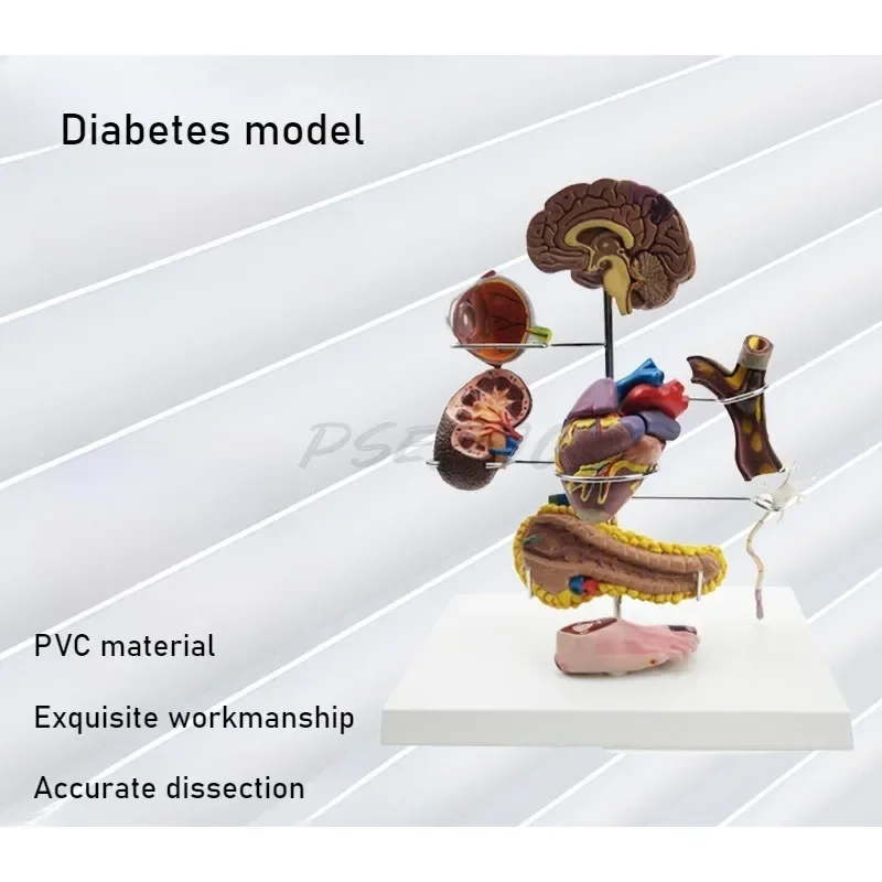 Diabetes Model Medicine Teaching Equipment Teaching Demonstration Supplies PVC Material Is Sturdy and Durable
Diabetes Model Medicine Teaching Equipment Teaching Demonstration Supplies PVC Material Is Sturdy and Durable