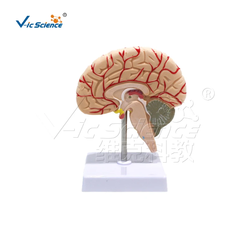 Anatomical model of the right hemisphere with digital identification of cerebral arteries
Anatomical model of the right hemisphere with digital identification of cerebral arteries