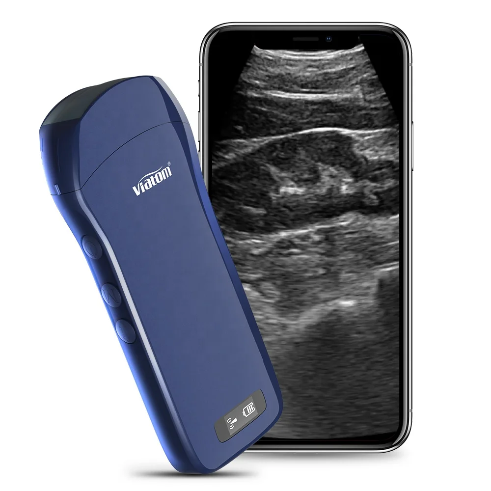 Viatom C10 Wireless Wifi Ultrasound Scanner Color Doppler Portable Echographie Machine Wireless Ultrasound
Viatom C10 Wireless Wifi Ultrasound Scanner Color Doppler Portable Echographie Machine Wireless Ultrasound