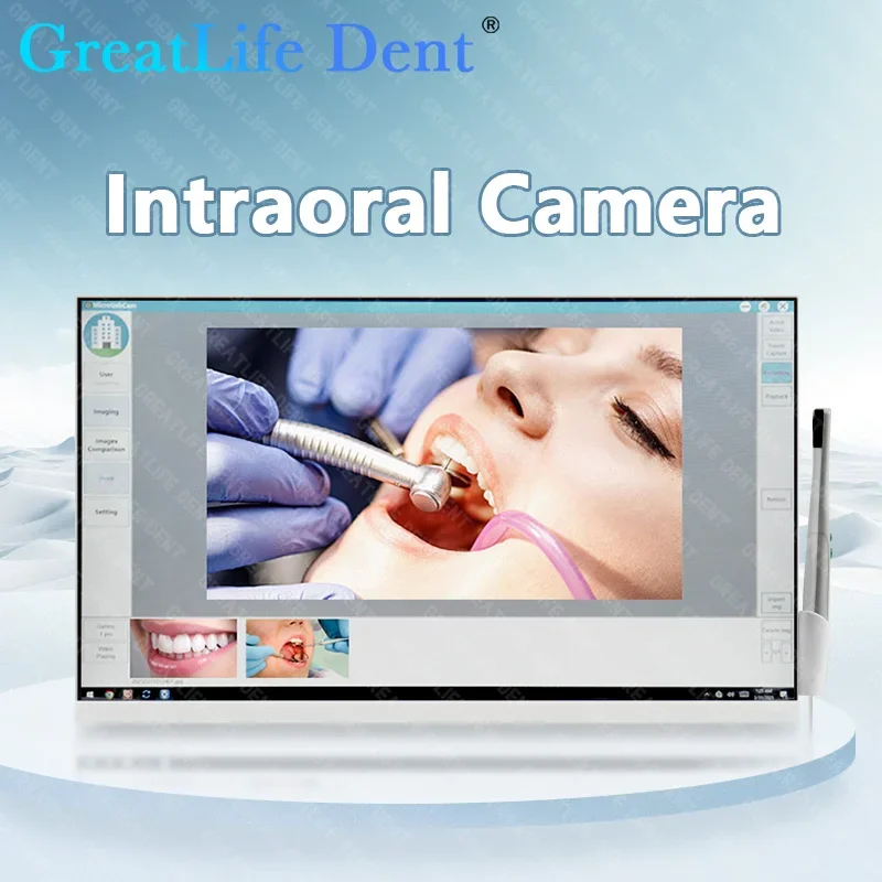 GreatLife Dental Endoscope Camera 24inch High-definition LCD Monitor Intraoral WiFi Camera For Dentist Wireless Intraoral Camera
GreatLife Dental Endoscope Camera 24inch High-definition LCD Monitor Intraoral WiFi Camera For Dentist Wireless Intraoral Camera