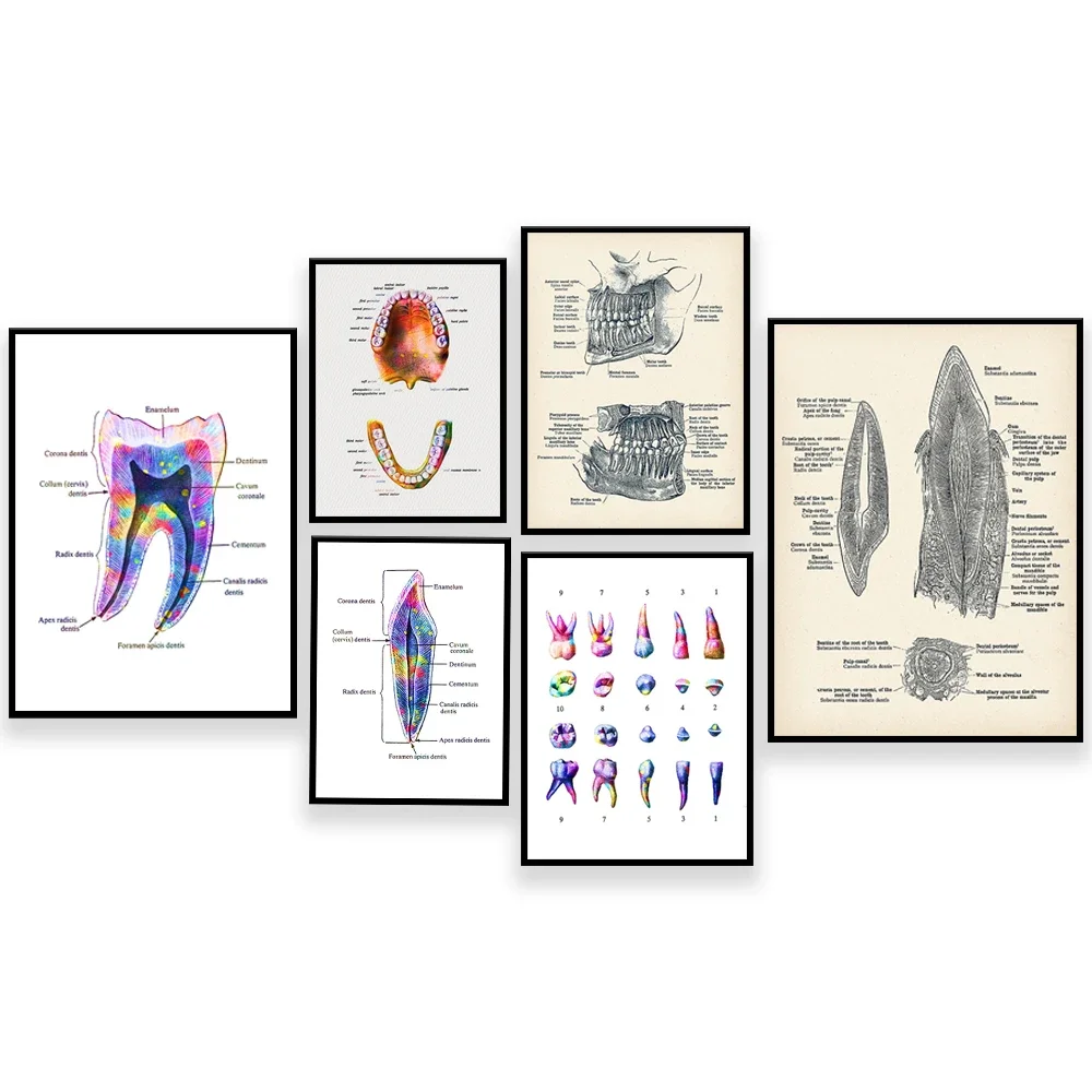 Dental posters dental anatomy prints anatomy jaws medicine art dental clinic decoration dentist gift orthodontist office gift
Dental posters dental anatomy prints anatomy jaws medicine art dental clinic decoration dentist gift orthodontist office gift