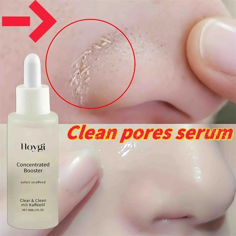 Salicylic Acid Night Serum Clean Pores Exfoliation Reduce Redness Acne Marks Pigmentation Oil Control Repair Facial Skin Care
Salicylic Acid Night Serum Clean Pores Exfoliation Reduce Redness Acne Marks Pigmentation Oil Control Repair Facial Skin Care