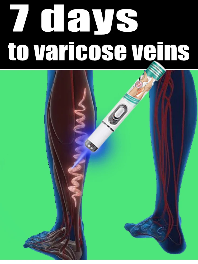 Second generation upgraded style blue light pen solve varicose veins, hot sale leg care tools
Second generation upgraded style blue light pen solve varicose veins, hot sale leg care tools