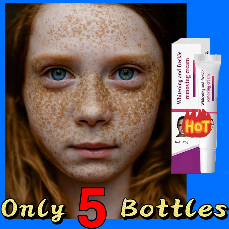FreckleWhiteningCreamBlackDotsMelasmaRemovalAntiBrownStainLightenPigmentationMoisturizingSkinCareProducts
FreckleWhiteningCreamBlackDotsMelasmaRemovalAntiBrownStainLightenPigmentationMoisturizingSkinCareProducts