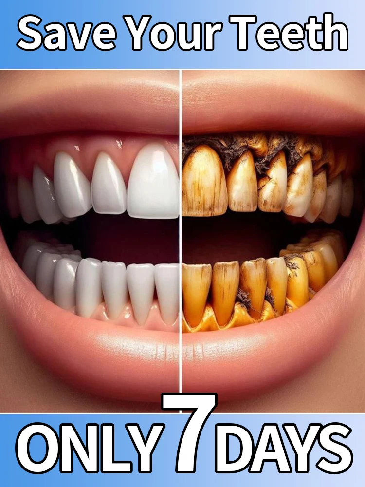 Dental calculus remover, bad breath removal, whitening and brightening, prevention of periodontitis, teeth cleaning
Dental calculus remover, bad breath removal, whitening and brightening, prevention of periodontitis, teeth cleaning