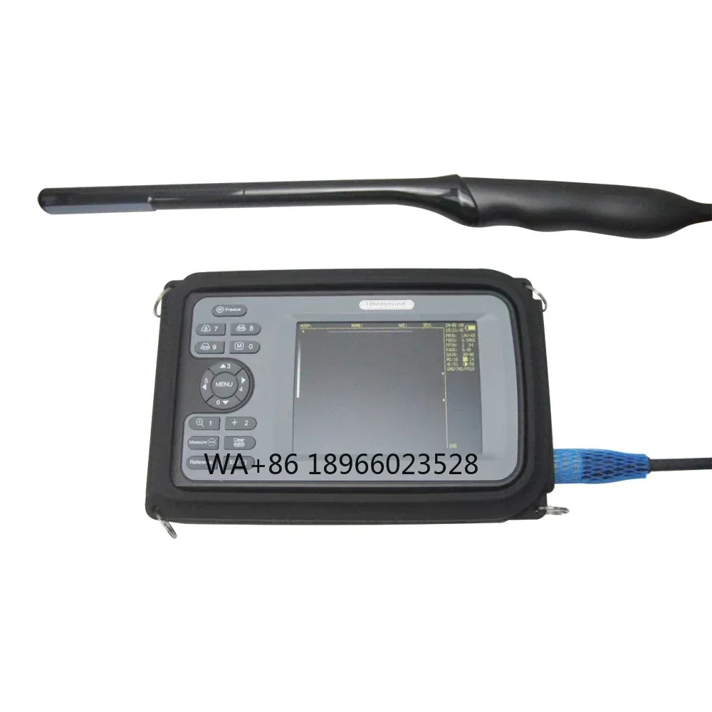 Portable Ultrasound Machine Animal Soundscape Test USG Goat Sheep Rectal Probe Veterinary Ultrasound Machine
Portable Ultrasound Machine Animal Soundscape Test USG Goat Sheep Rectal Probe Veterinary Ultrasound Machine