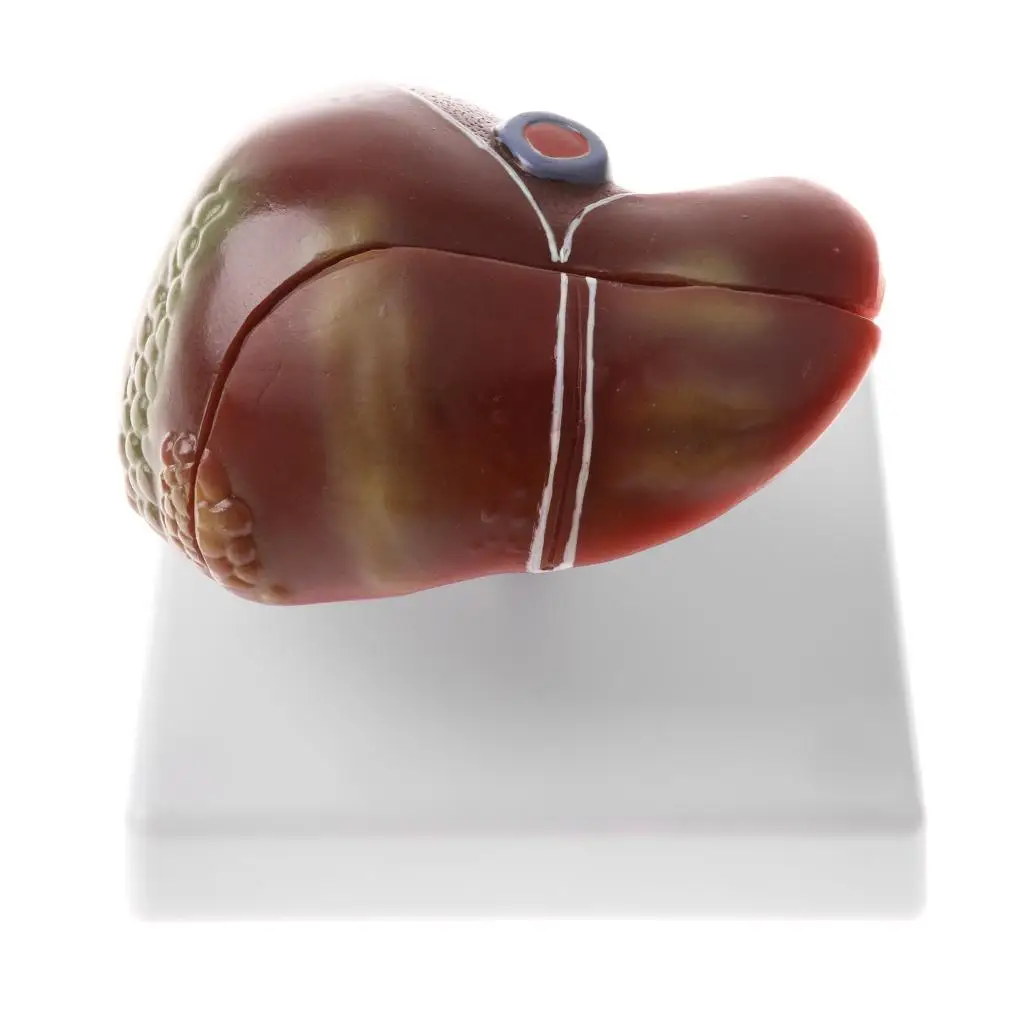 PVC Human Liver Structure Statue Anatomy Learning Model for School Teaching Kits Medical Lab Display
PVC Human Liver Structure Statue Anatomy Learning Model for School Teaching Kits Medical Lab Display