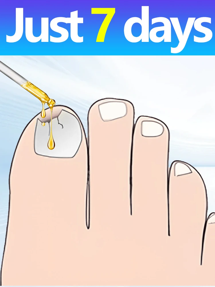 Горячее обслуживание 2025 года — омоложение — технология предотвращения грибка — регулируемый датчик управления и безопасности, унисекс
Горячее обслуживание 2025 года — омоложение — технология предотвращения грибка — регулируемый датчик управления и безопасности, унисекс