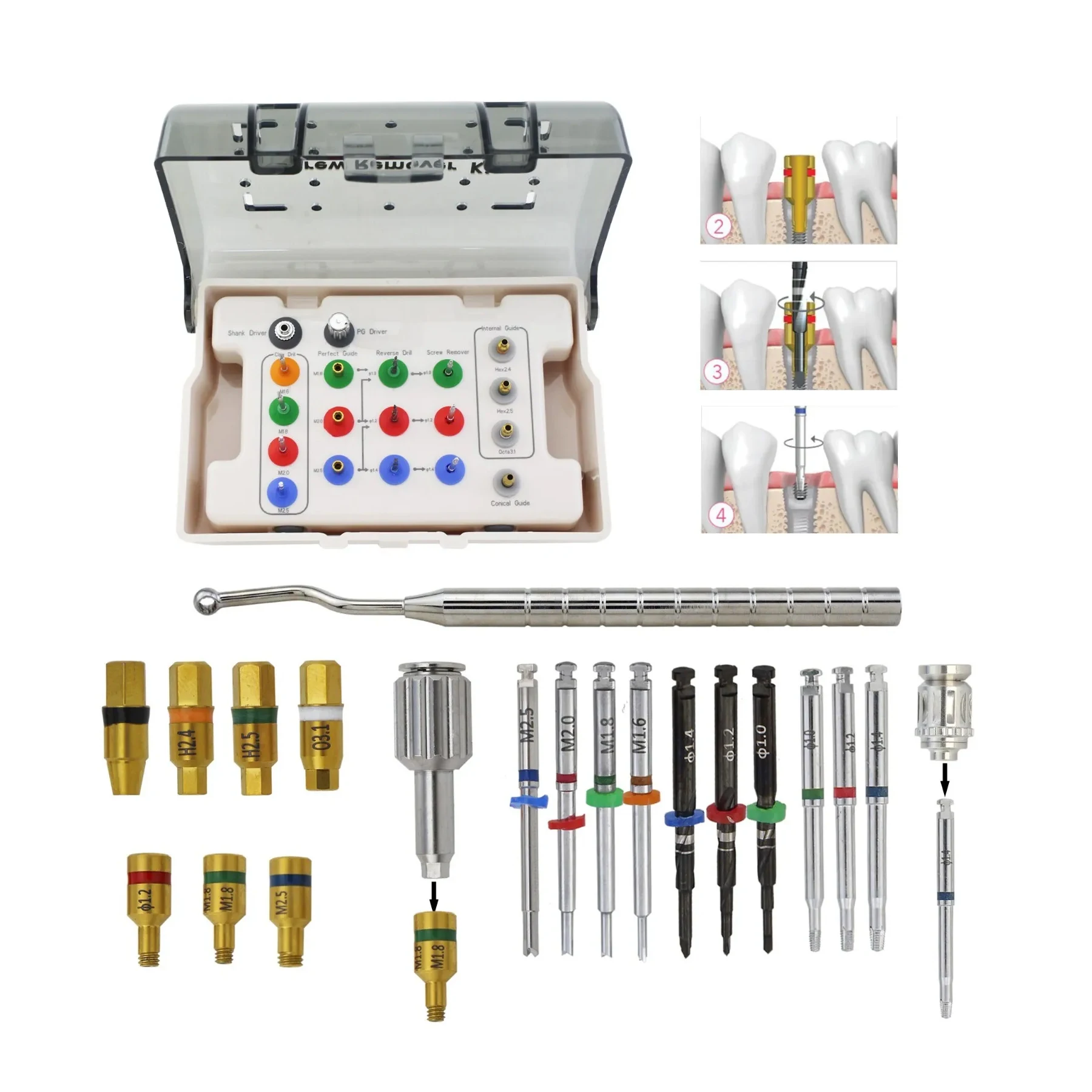 Dental Implant Broken Screw Remover Kit Surgical Tool Instrument NeoBiotech SR Driver Holder
Dental Implant Broken Screw Remover Kit Surgical Tool Instrument NeoBiotech SR Driver Holder