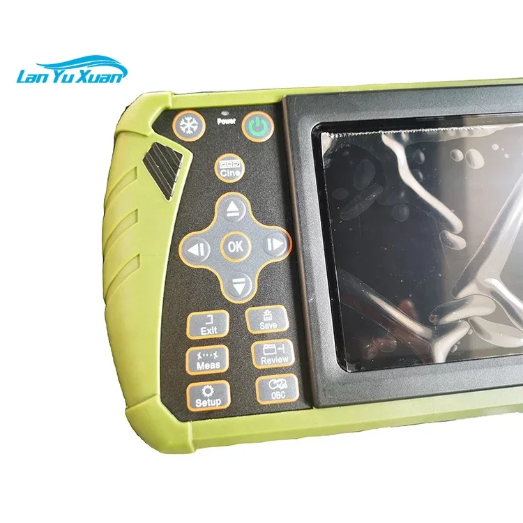 2025/Veterinary cow horse sheep dog cat goat pig camel Pregnant Ultrasound Scanner Portable
2025/Veterinary cow horse sheep dog cat goat pig camel Pregnant Ultrasound Scanner Portable
