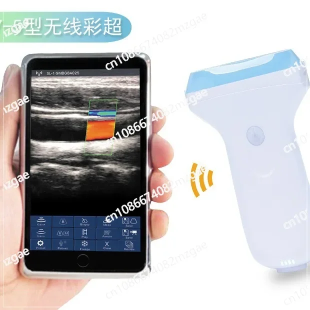 Ultrasound Color Handheld Wireless Ultrasonic Device Four Dimensional Color Pet Veterinary Ultrasonic Device
Ultrasound Color Handheld Wireless Ultrasonic Device Four Dimensional Color Pet Veterinary Ultrasonic Device