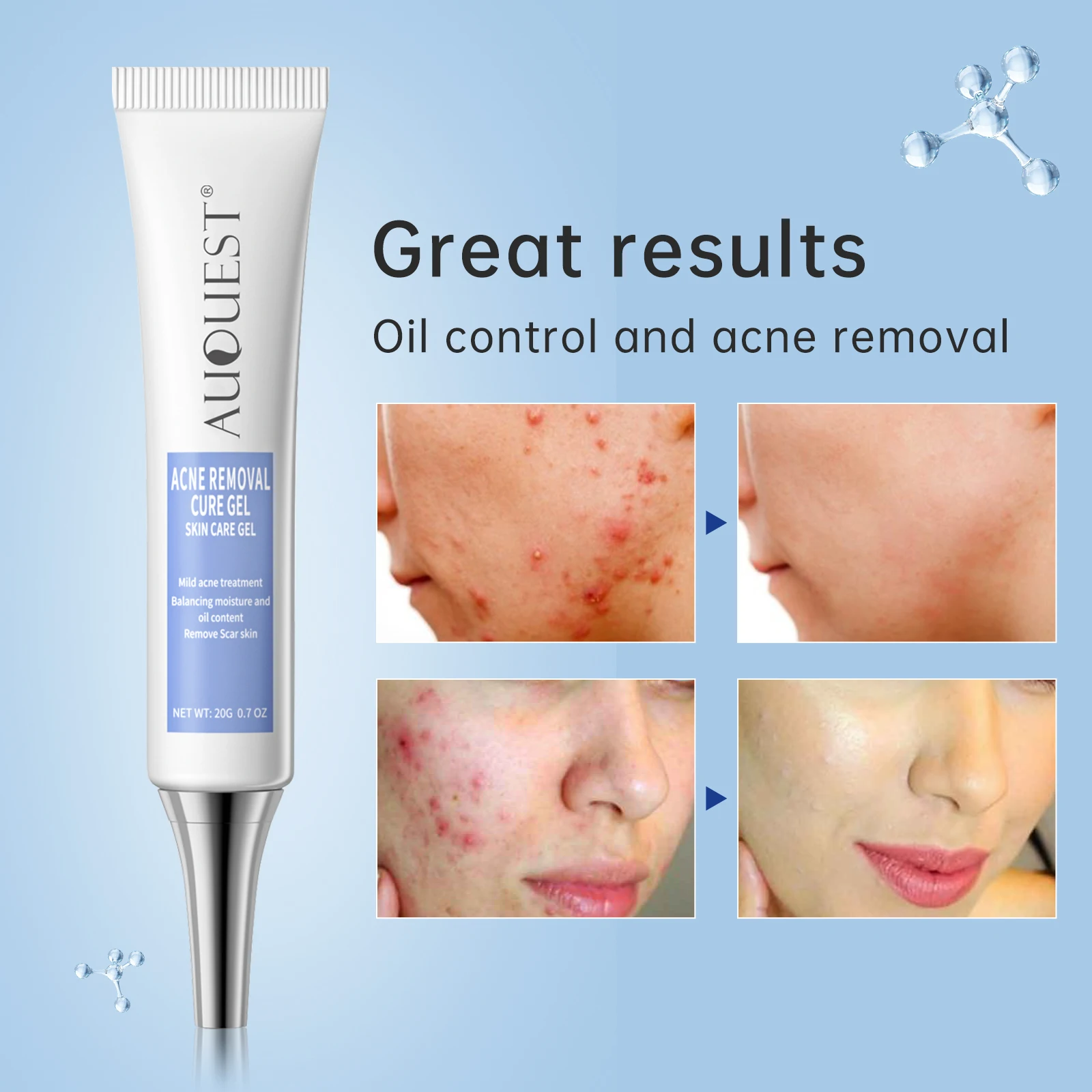 Acid Pore Shrink Face Cream Hyaluronic Acid Moisturizing Nourish Smooth Pores Repair Essence Firm Korean Cosmetics
Acid Pore Shrink Face Cream Hyaluronic Acid Moisturizing Nourish Smooth Pores Repair Essence Firm Korean Cosmetics