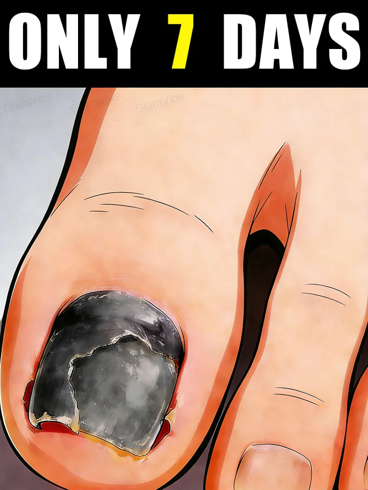 Инновационное средство! Попрощайтесь с желтизной и тусклостью!
Инновационное средство! Попрощайтесь с желтизной и тусклостью!