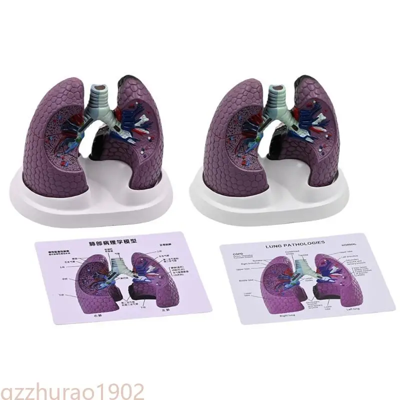 97QB Human Anatomical Lung Model Realistic Pathological Lung Anatomy Model for Teaching Demonstration and Educational Use
97QB Human Anatomical Lung Model Realistic Pathological Lung Anatomy Model for Teaching Demonstration and Educational Use