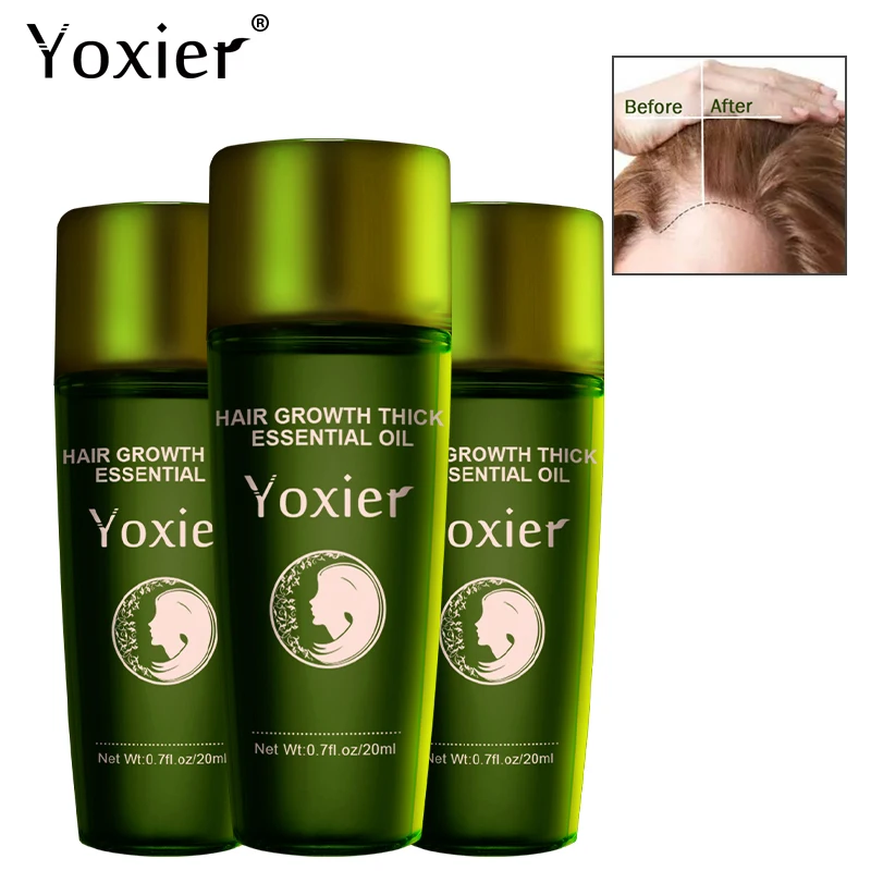 Yoxier 3 шт., эссенционное масло для роста волос, эффективный экстракт, против питания корней волос, предотвращение выпадения волос, средства по уходу за волосами
Yoxier 3 шт., эссенционное масло для роста волос, эффективный экстракт, против питания корней волос, предотвращение выпадения волос, средства по уходу за волосами
