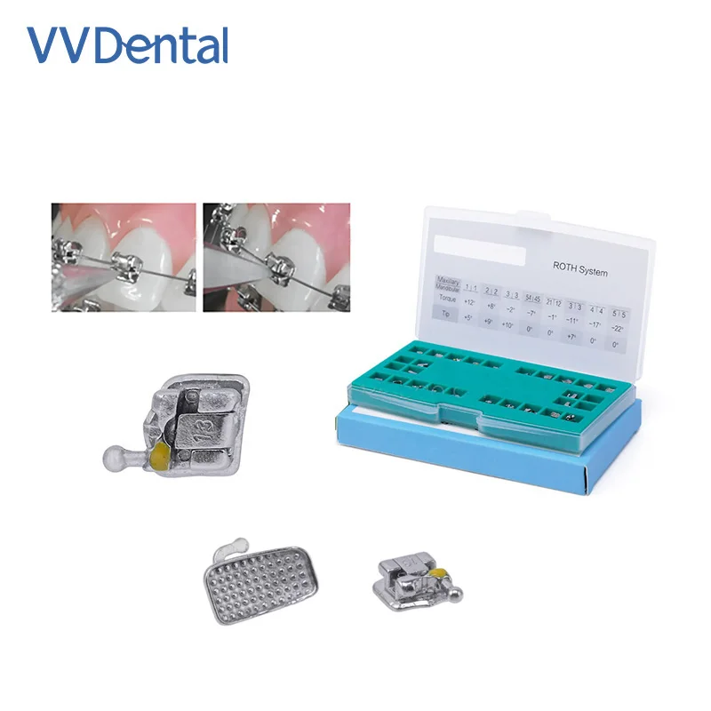 Стоматологический ортодонтический металлический самолигирующийся кронштейн MBT/Roth 3/4 с крючками или компактный кронштейн мини-брекеты новейшего типа, высокое качество
Стоматологический ортодонтический металлический самолигирующийся кронштейн MBT/Roth 3/4 с крючками или компактный кронштейн мини-брекеты новейшего типа, высокое качество