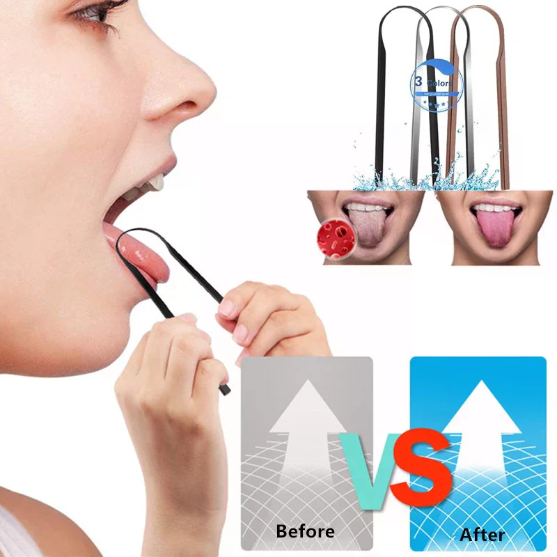 Скребок для языка из нержавеющей стали, чистка свежего дыхания, зубная щетка для языка с покрытием, гигиена полости рта, U-образный металлический скребок для языка
Скребок для языка из нержавеющей стали, чистка свежего дыхания, зубная щетка для языка с покрытием, гигиена полости рта, U-образный металлический скребок для языка