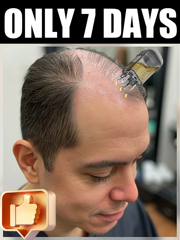 100% revive hair, strong penetration, activate hair roots, more hair, say goodbye to baldness, thick hair
100% revive hair, strong penetration, activate hair roots, more hair, say goodbye to baldness, thick hair