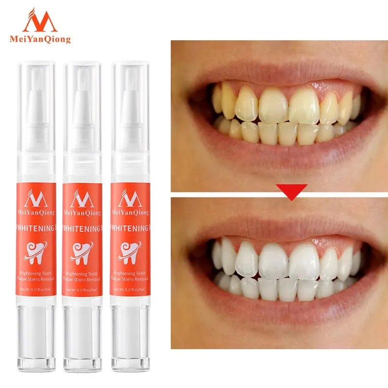 3pcs Tooth whitening pen Teeth whitening Clean mouth Tartar Removal Brightening Teeth Fresh Breath Removing stains Toothpaste
3pcs Tooth whitening pen Teeth whitening Clean mouth Tartar Removal Brightening Teeth Fresh Breath Removing stains Toothpaste