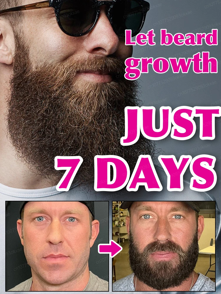 Beard growth essence. It helps your beard grow quickly, and is a must-have for mature men. It makes you look more manly and is e
Beard growth essence. It helps your beard grow quickly, and is a must-have for mature men. It makes you look more manly and is e