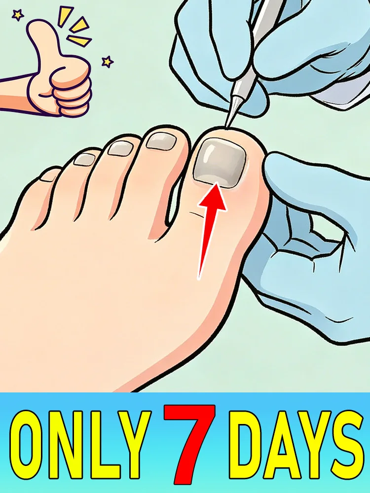 Trusted daily nail care system uses fine nursing method to effectively guard nail health all the whole time
Trusted daily nail care system uses fine nursing method to effectively guard nail health all the whole time