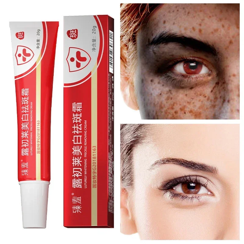 Removal Melasma Facial Cream That Whitens The Skin Eliminates Freckles Anti-aging Moisturizing Cream Remove Dark Spots Age Spots
Removal Melasma Facial Cream That Whitens The Skin Eliminates Freckles Anti-aging Moisturizing Cream Remove Dark Spots Age Spots
