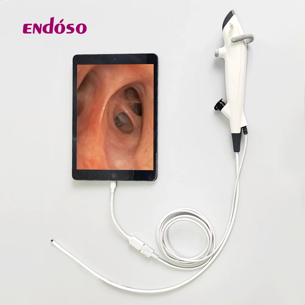 Endoso 2.8mm Portable Endoscope Digital Video Bronchoscope Flexible USB with MDR
Endoso 2.8mm Portable Endoscope Digital Video Bronchoscope Flexible USB with MDR