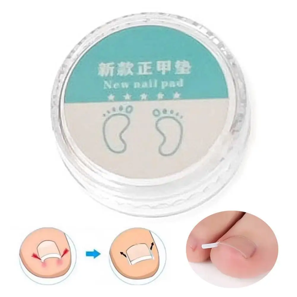 50pcs/box Ingrown Toe Nail Treatment Ingrown Toenail Correction Tool Elastic Patch Sticker Straightening Clip Brace Pedicure
50pcs/box Ingrown Toe Nail Treatment Ingrown Toenail Correction Tool Elastic Patch Sticker Straightening Clip Brace Pedicure