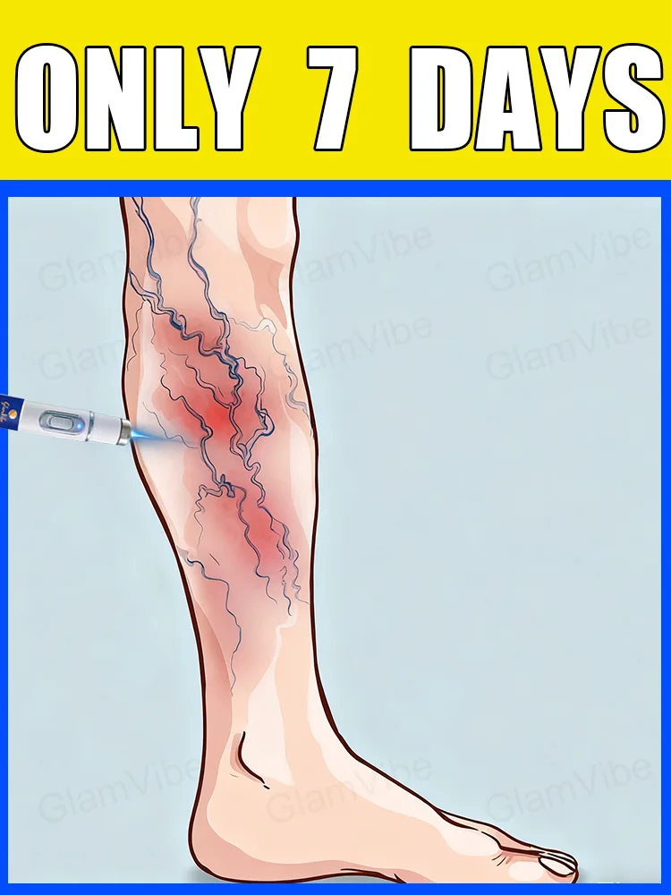 Generation-2 Laser Says Goodbye To Spider Legs Varicose In 7 Days
Generation-2 Laser Says Goodbye To Spider Legs Varicose In 7 Days