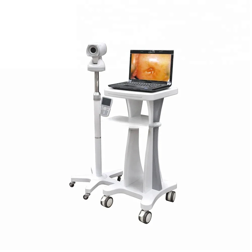 Gynecology full hd Digital Electronic Video Colposcopy for Gynecology/Colposcopy Machine
Gynecology full hd Digital Electronic Video Colposcopy for Gynecology/Colposcopy Machine