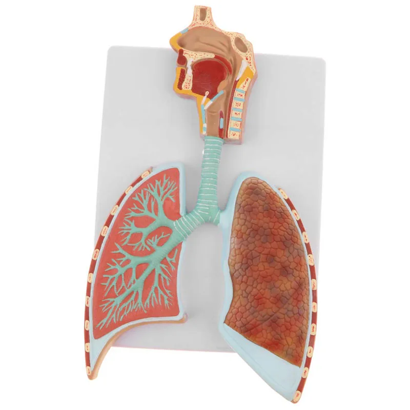 Human Respiratory System Lung Lobes Alveoli Anatomy Model Medical Science Teaching Resources Dropshipping
Human Respiratory System Lung Lobes Alveoli Anatomy Model Medical Science Teaching Resources Dropshipping