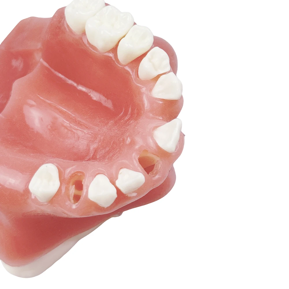 Dental Implant Model Missing Tooth Maxillary Sinus Training Model Upper Jaw Implant Practice Teeth Model For Student Studying
Dental Implant Model Missing Tooth Maxillary Sinus Training Model Upper Jaw Implant Practice Teeth Model For Student Studying