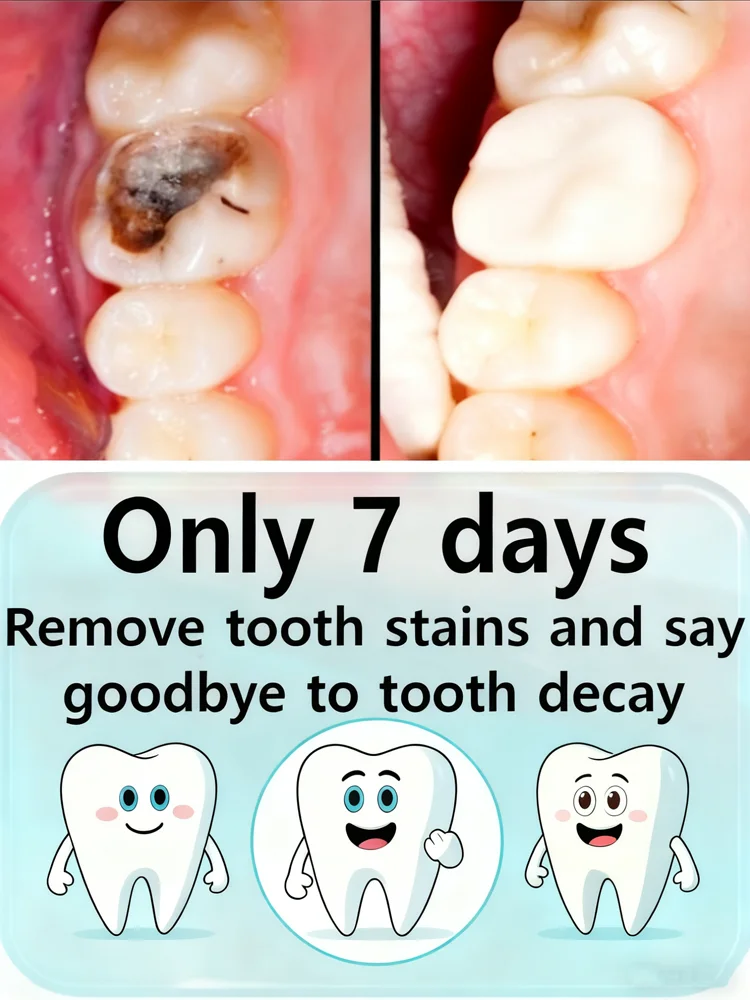 Зубная паста для ежедневного ухода за деснами - нежная формула, успокаивает чувствительность, глубоко восстанавливает жевательные и белые зубы.
Зубная паста для ежедневного ухода за деснами - нежная формула, успокаивает чувствительность, глубоко восстанавливает жевательные и белые зубы.