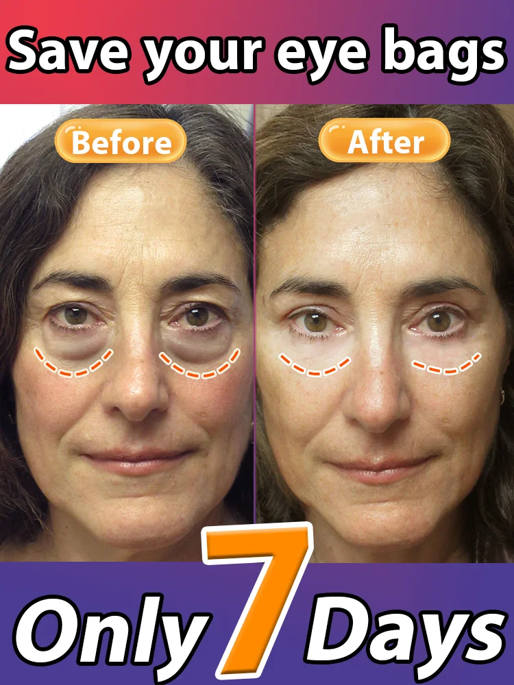 The best products of 2025,ᴵⁿˢᵗᵃⁿᵗˡʸ ʳᵉᵐᵒᵛᵉ ᵉʸᵉ ᵇᵃᵍˢ⸴ ʳᵉᵈᵘᶜᵉ ᶠⁱⁿᵉ ˡⁱⁿᵉˢ⸴ ᵗⁱᵍʰᵗᵉⁿ ˢᵏⁱⁿ⸴ ᶠⁱᵍʰᵗ ᵈᵃʳᵏ ᶜⁱʳᶜˡᵉˢ⸴ ᵃⁿᵈ ᵇʳⁱᵍʰᵗᵉⁿ ᵉʸᵉˢ
The best products of 2025,ᴵⁿˢᵗᵃⁿᵗˡʸ ʳᵉᵐᵒᵛᵉ ᵉʸᵉ ᵇᵃᵍˢ⸴ ʳᵉᵈᵘᶜᵉ ᶠⁱⁿᵉ ˡⁱⁿᵉˢ⸴ ᵗⁱᵍʰᵗᵉⁿ ˢᵏⁱⁿ⸴ ᶠⁱᵍʰᵗ ᵈᵃʳᵏ ᶜⁱʳᶜˡᵉˢ⸴ ᵃⁿᵈ ᵇʳⁱᵍʰᵗᵉⁿ ᵉʸᵉˢ