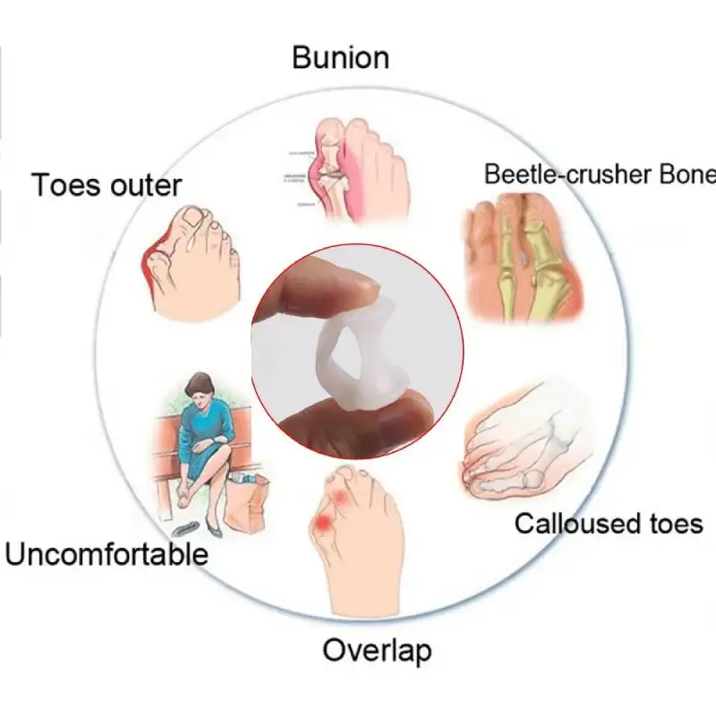 1/10/50Pairs Silicone Toe Separator Finger Feet Care Protector Gel Toe Orthopedic Bunion Hallux Valgus Corrector Pedicure Spacer
1/10/50Pairs Silicone Toe Separator Finger Feet Care Protector Gel Toe Orthopedic Bunion Hallux Valgus Corrector Pedicure Spacer