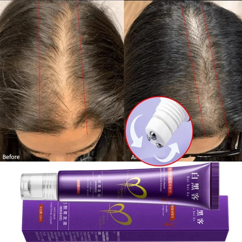 Rapid Hair Growth Essence AntiShedding Hair Growth Dense Hair Deeply Nourish Hair Follicles Hair Care Essence 
Rapid Hair Growth Essence AntiShedding Hair Growth Dense Hair Deeply Nourish Hair Follicles Hair Care Essence