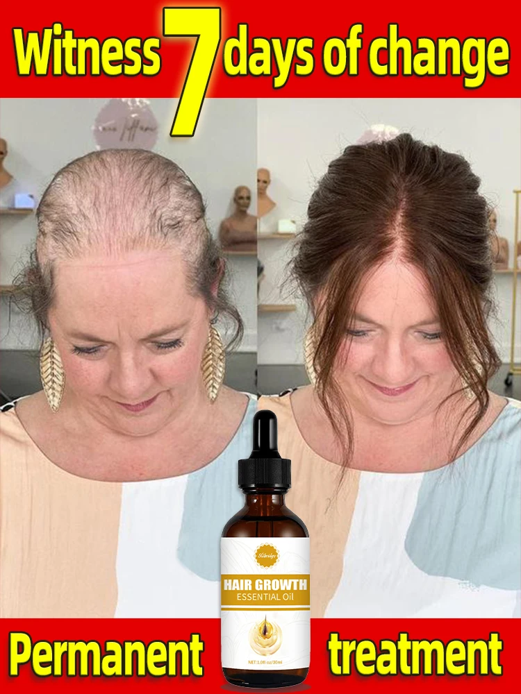 Sólo se necesitan 7 días para reparar la calvicie. El aceite esencial para el crecimiento del cabello puede reparar eficazmente
Sólo se necesitan 7 días para reparar la calvicie. El aceite esencial para el crecimiento del cabello puede reparar eficazmente
