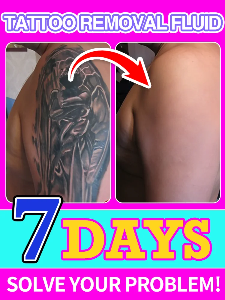 Professional-grade tattoo removal: 7-day natural formula effectively decomposes pigment without leaving marks
Professional-grade tattoo removal: 7-day natural formula effectively decomposes pigment without leaving marks