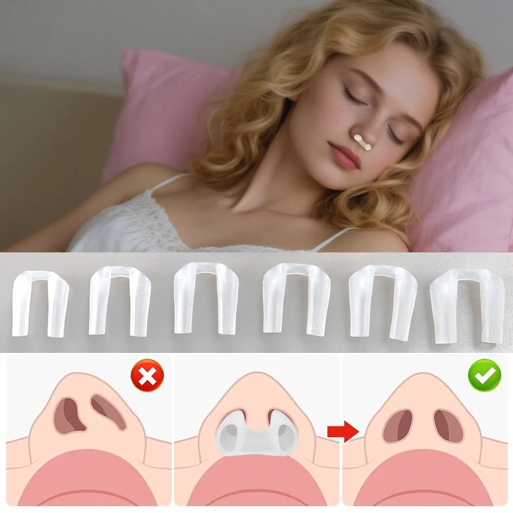 2-пак. фиксатор ноздрей, шина для носа для восстановления ринопластики, высококачественное силиконовое устройство для формирования носа, вспомогательное устройство для восстановления ноздрей
2-пак. фиксатор ноздрей, шина для носа для восстановления ринопластики, высококачественное силиконовое устройство для формирования носа, вспомогательное устройство для восстановления ноздрей