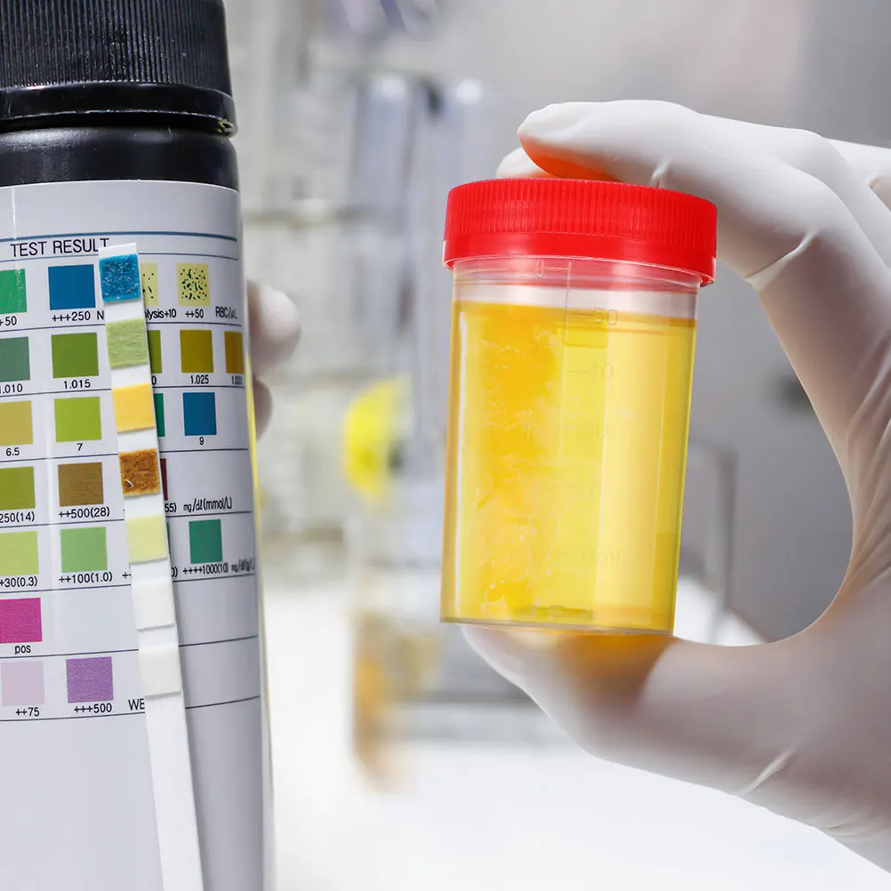 50pcs Urine Specimen Cups Plastic Leak-Proof Sample Containers For Lab Testing Fecal Fluid Collection Medical Teaching Equipment
50pcs Urine Specimen Cups Plastic Leak-Proof Sample Containers For Lab Testing Fecal Fluid Collection Medical Teaching Equipment