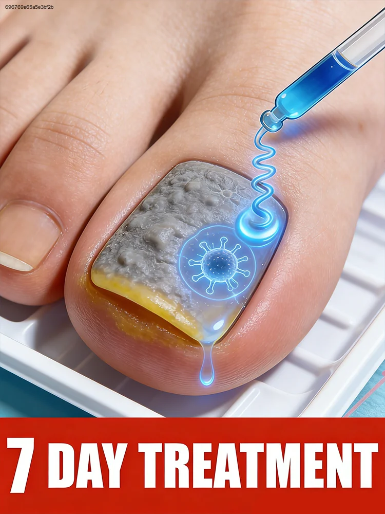 Non-irritating and skin-friendly, repairing onychomycosis (fungal nail infection)
Non-irritating and skin-friendly, repairing onychomycosis (fungal nail infection)