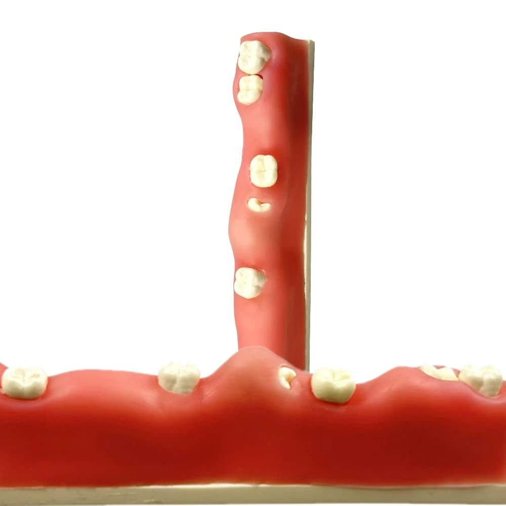 Dental Impacted Tooth Model Unerupted Tooth Extraction Practice Training Model Resin Wisdom Teeth For Dentistry Teaching Study
Dental Impacted Tooth Model Unerupted Tooth Extraction Practice Training Model Resin Wisdom Teeth For Dentistry Teaching Study
