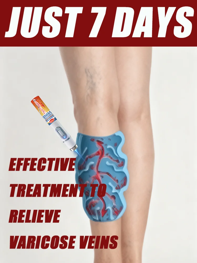 Tʀᴇᴀᴛᴍᴇɴᴛ ʀᴇʟɪᴇᴠᴇs ᴘᴀɪɴ ғʀᴏᴍ ᴠᴀʀɪᴄᴏsᴇ ᴠᴇɪɴs ɪɴ ᴛʜᴇ ʟᴇɢs, promoting overall health.
Tʀᴇᴀᴛᴍᴇɴᴛ ʀᴇʟɪᴇᴠᴇs ᴘᴀɪɴ ғʀᴏᴍ ᴠᴀʀɪᴄᴏsᴇ ᴠᴇɪɴs ɪɴ ᴛʜᴇ ʟᴇɢs, promoting overall health.