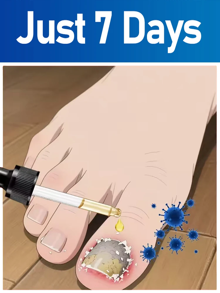 Мощное средство для восстановления и коррекции формы, эффективно лечит и предотвращает повторное появление грибка ногтей.
Мощное средство для восстановления и коррекции формы, эффективно лечит и предотвращает повторное появление грибка ногтей.