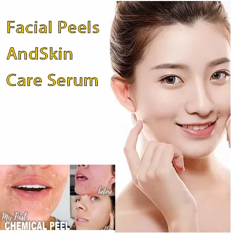 With Malic Acid And Citric Acid For Face Facial Peeling Serum Peeling Serum Chemical Peel Whitening Nourishing Essence454
With Malic Acid And Citric Acid For Face Facial Peeling Serum Peeling Serum Chemical Peel Whitening Nourishing Essence454