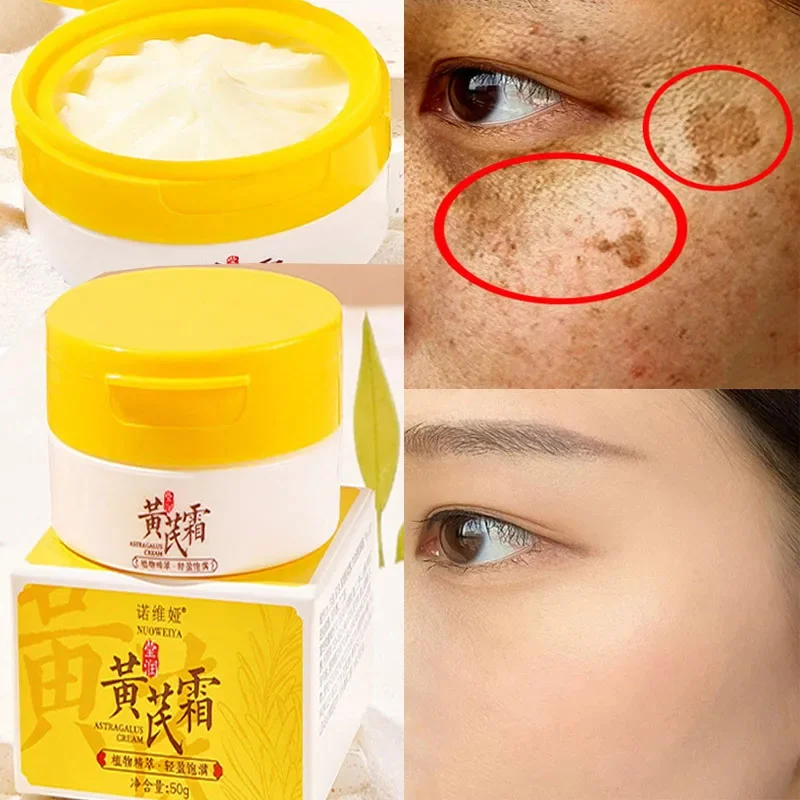Effective Whitening Freckles Cream Remove Dark Spots Fade Melanin Anti-Pigmentation Improve Dullness Fast Brighten Skin Care
Effective Whitening Freckles Cream Remove Dark Spots Fade Melanin Anti-Pigmentation Improve Dullness Fast Brighten Skin Care