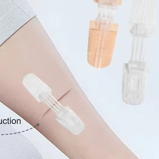 Zipper Tie Wound Closure Patch Zipper Band-Aid Wound Fast Suture Outdoor Portable Hemostatic Patch First Aid Tool
Zipper Tie Wound Closure Patch Zipper Band-Aid Wound Fast Suture Outdoor Portable Hemostatic Patch First Aid Tool