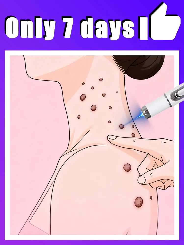 blue light pen solve warts,unisex, hot sale wart care tools,Free shipping
blue light pen solve warts,unisex, hot sale wart care tools,Free shipping