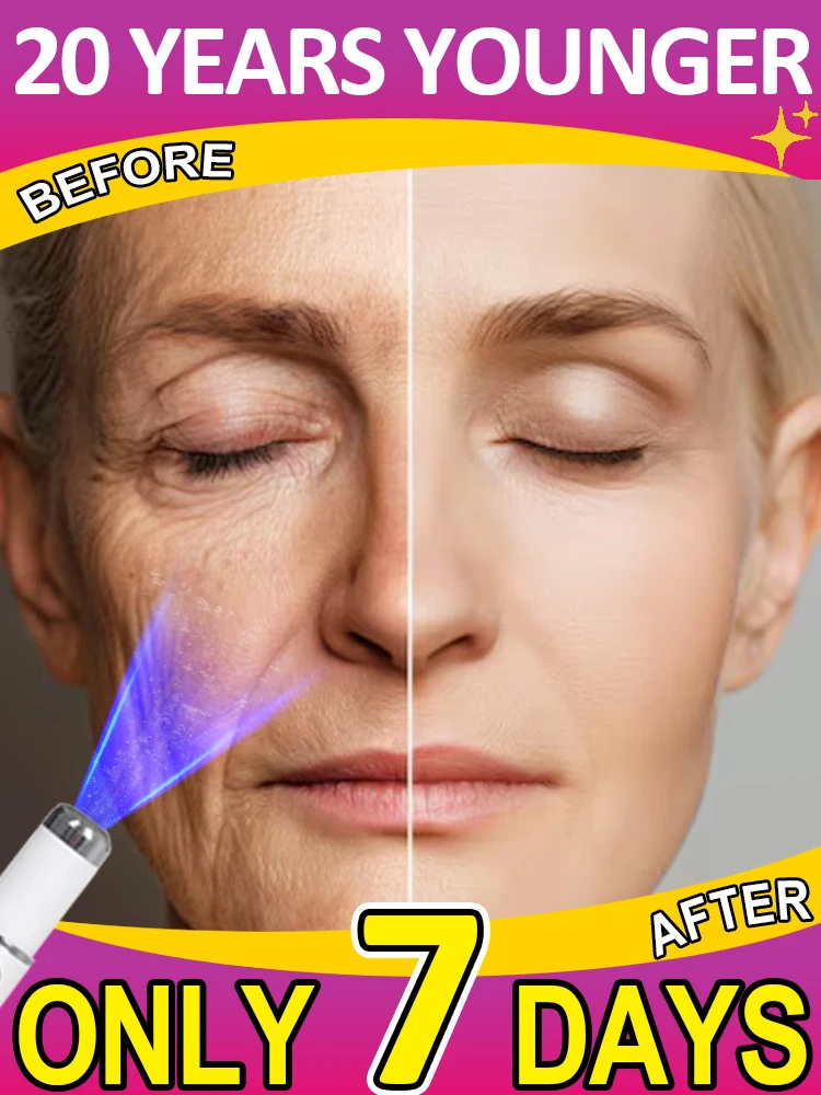 20-летний младший, 100% стирание морщин
20-летний младший, 100% стирание морщин