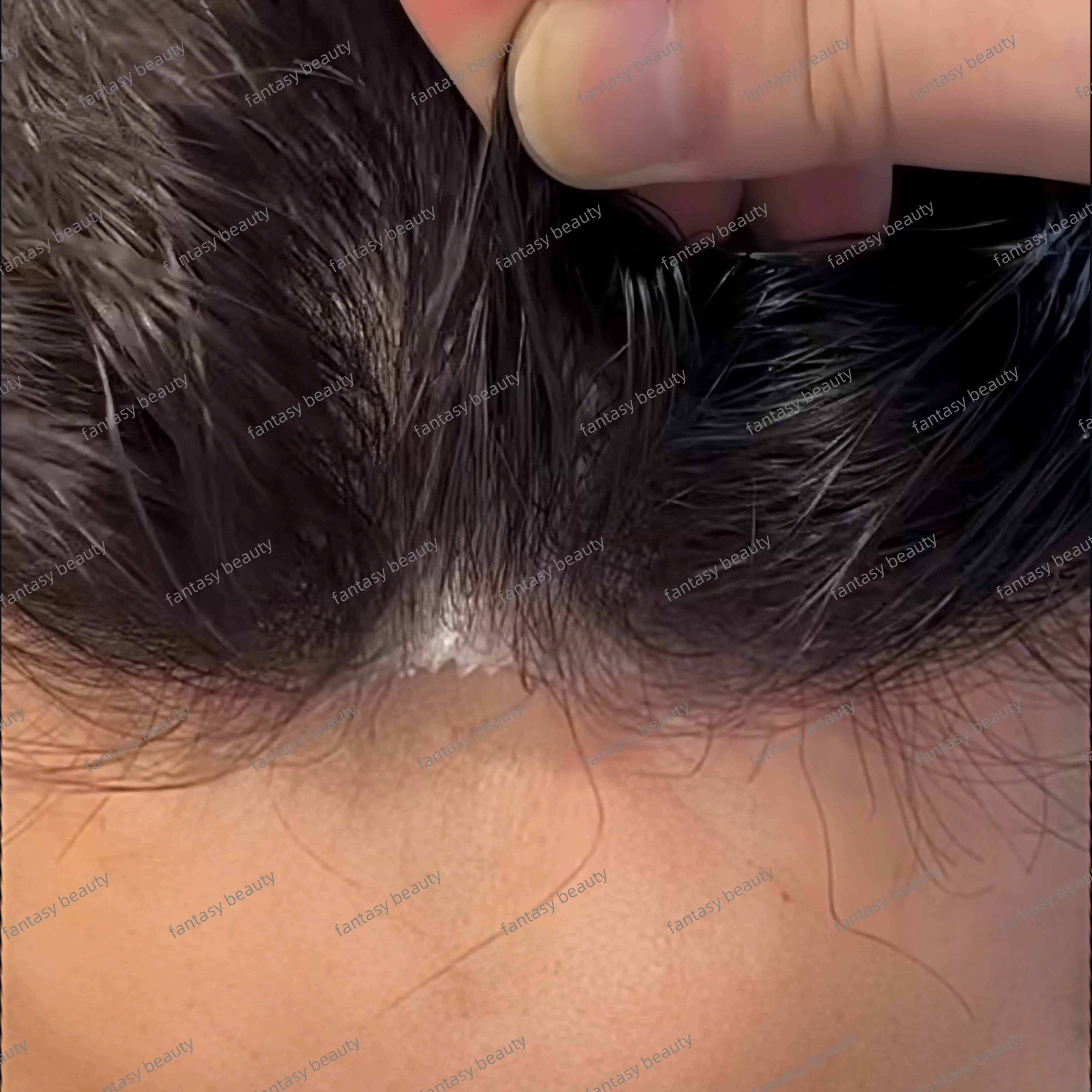 Toupee Wigs Human Hair For Men Ultra-Thin 0.03mm Skin PU Base Hair Prosthesis Man #1#1B Natural black Men's Capillary Prosthesis
Toupee Wigs Human Hair For Men Ultra-Thin 0.03mm Skin PU Base Hair Prosthesis Man #1#1B Natural black Men's Capillary Prosthesis